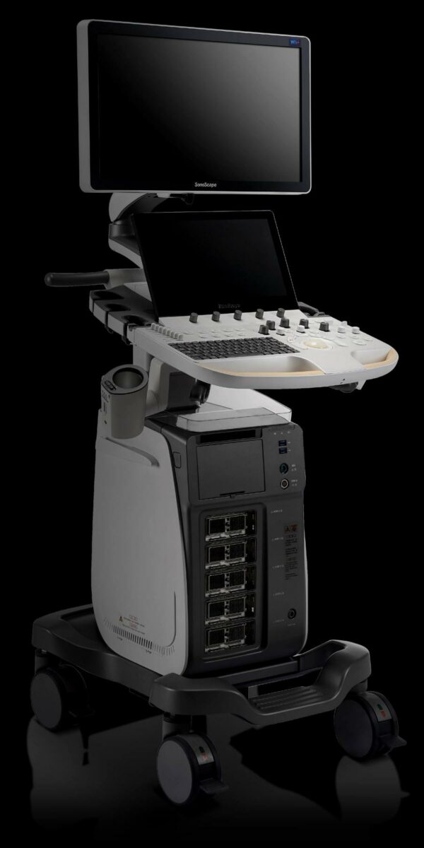 Sonoscape P60 Premium Ultrasound Machine