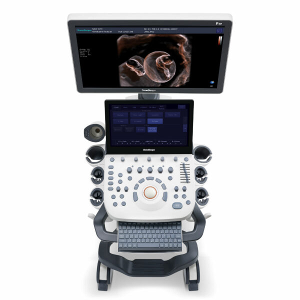 Sonoscape P20 Ultrasound Machine