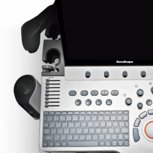 sonoscape p50 elite ultrasound machine