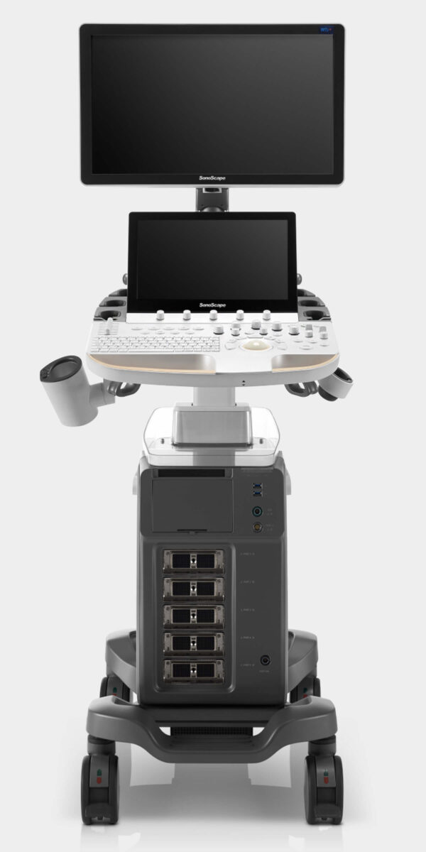 Sonoscape P60 Exp Ultrasound System