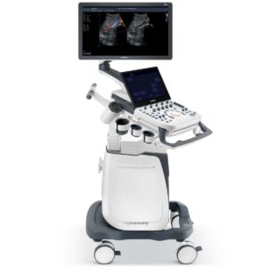 sonoscape p25 ultrasound machine